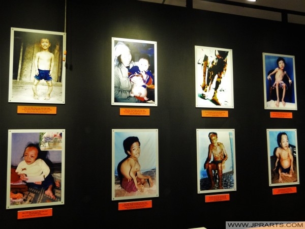 Exhibit about Effects of Agent Orange in the War Remnants Museum in Ho Chi Minh City, Vietnam
